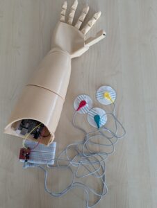 prosthetic device
